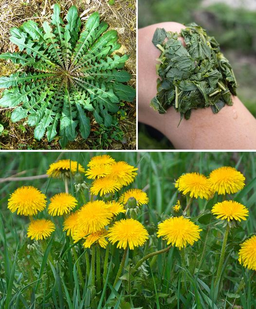 30 Incredible Benefits of Dandelion: Nature’s Hidden Gem